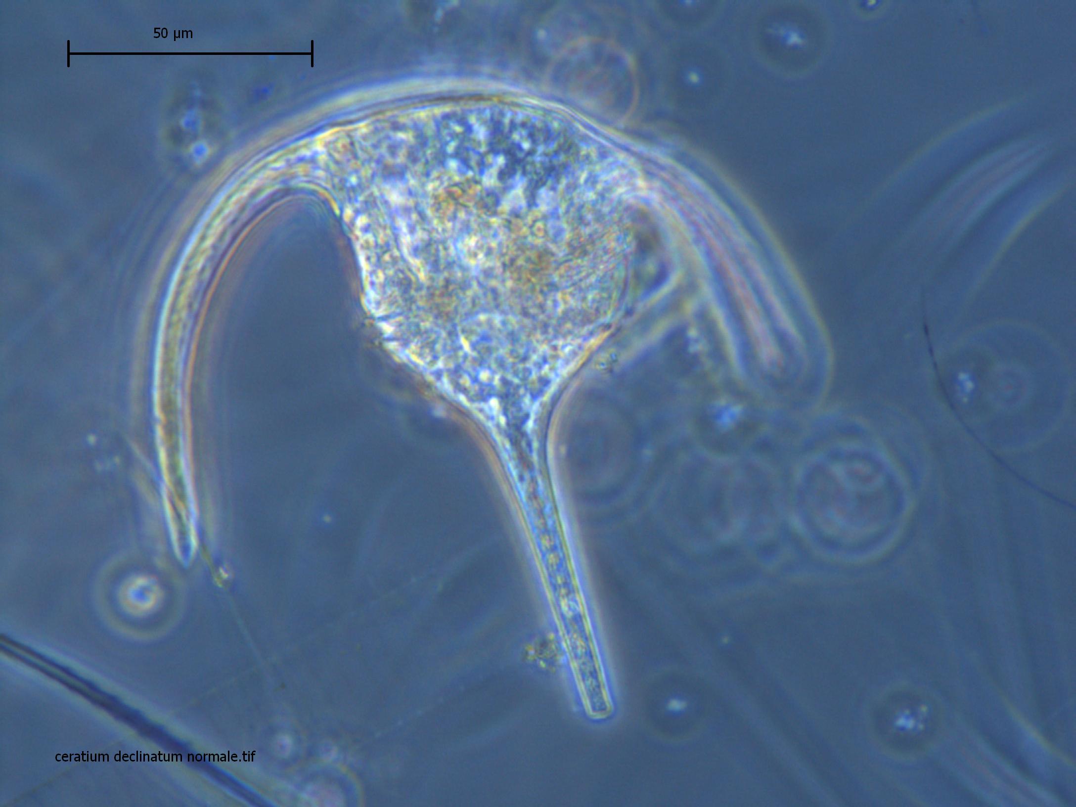 riconoscimento fitoplancton